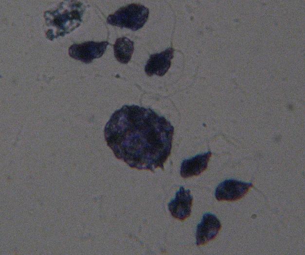 Stained Multiple Haematococcus